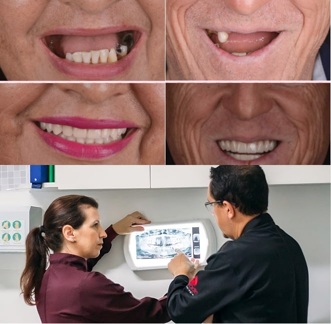 especialistas-em-implantes-dentários-em-guarujá-sp